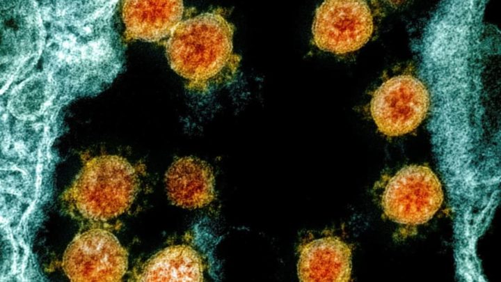 Bericht: US-Ministerium geht bei Coronavirus von Laborpanne aus